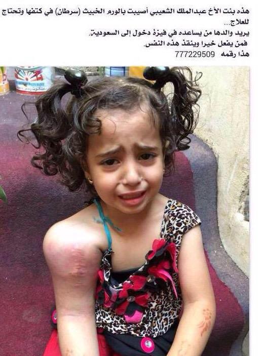 AleniziSH's tweet photo. حالة انسانية  طفلة يمنية مصابة بورم خبيث وتحتاج من يمد يد العون لها لدخول بلد الخير السعودية لعلاجها. http://t.co/ntivk6fzh9