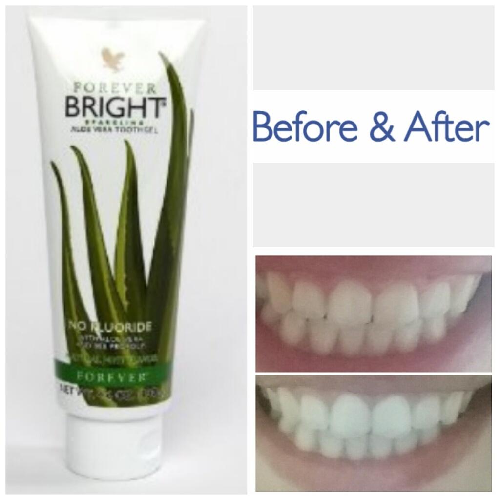 aloeharpers's tweet photo. Results after just 6 days of using forever bright 😍 #foreverliving #natural #teeth #aloe http://t.co/ifol7XJr1Q