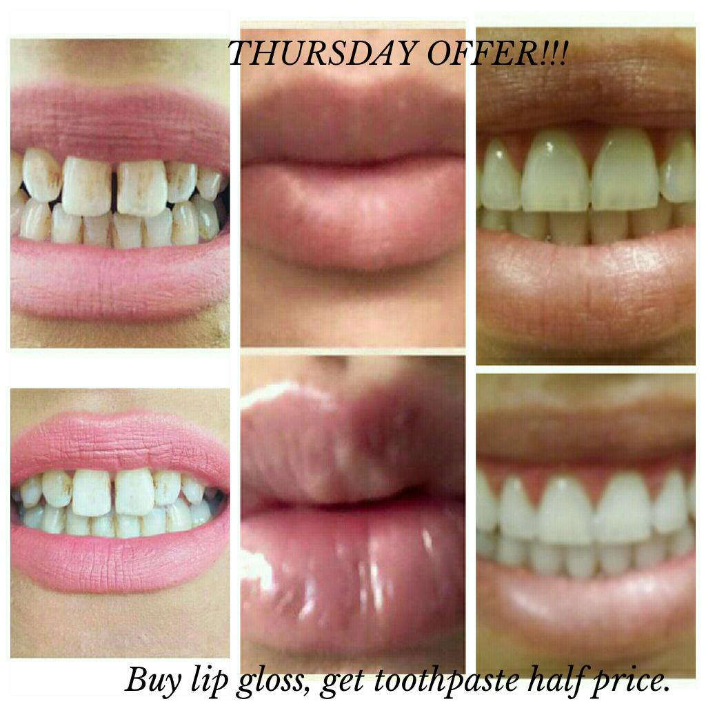 Hayliejane91's tweet photo. Buy a collegen enhancing lip gloss and get whitening toothpaste HALF PRICE #deals #teethwhitening #biglips dm me http://t.co/c7yn00MB8g