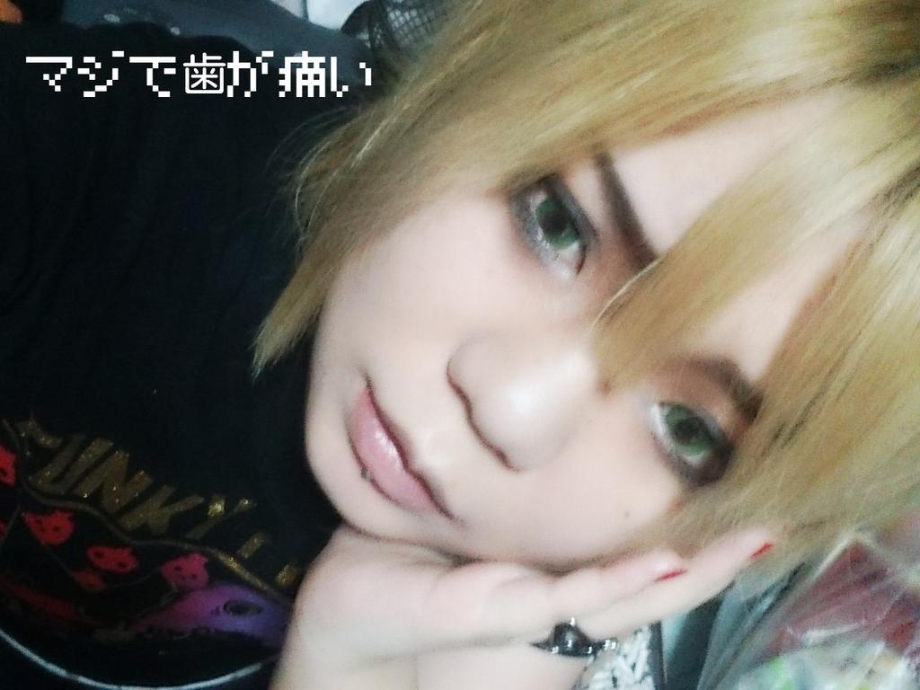 d_0416_d's tweet photo. まじで歯が痛いポーズのリリーさんです。親知らずってほんとやですね。 http://t.co/FqyFkOVsKW