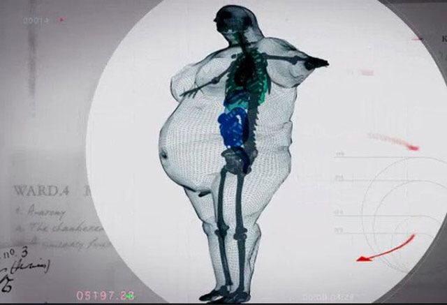 Buzztag_fr's tweet photo. 😱 Voici à quoi ressemble la radio d’un homme de 450 kilos

Plus d'infos → http://t.co/RXz2GsYhqL http://t.co/toZO3YDLgd