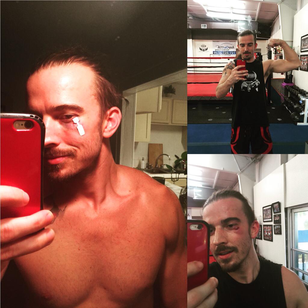 STerlingSiegfri's tweet photo. Working hard sometimes cuts u! No worries. #sparring #thenextbigthing #mma #health #training #bawarrior #kickboxing http://t.co/e9yiLc2SQv
