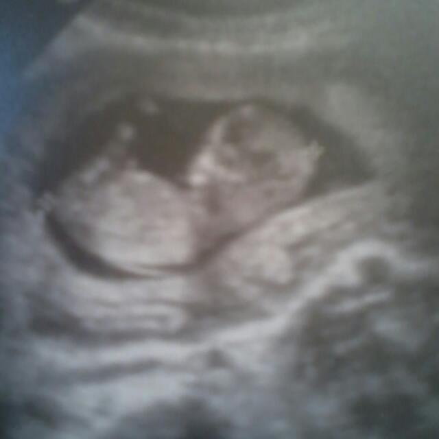 tatiysaray's tweet photo. Nuestro gargancito...k ganas tengo de k estes ya aki http://t.co/cY5jS5TIlF