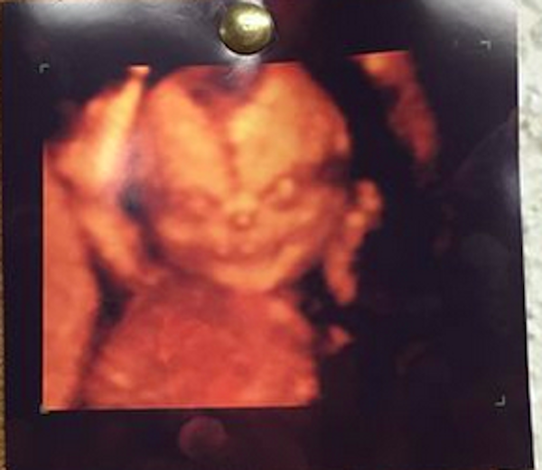 BuzzFeed on Twitter: "Apparently, a 4D ultrasound can make your baby look  like a demon http://t.co/G7llnICkkW http://t.co/rAARmKjQJ6" / Twitter