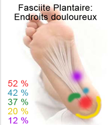 #fasciiteplantaire #plantarfasciitis une des douleurs facilement traitée par #laser résultats rapides et durables