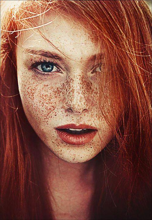 Lumeecase's tweet photo. Does the summer sun bring out your freckles? Show us your #freckle pride! #LuMeeSelfie #welovefreckles #dontforgetSPF http://t.co/AiV7KWbbgG