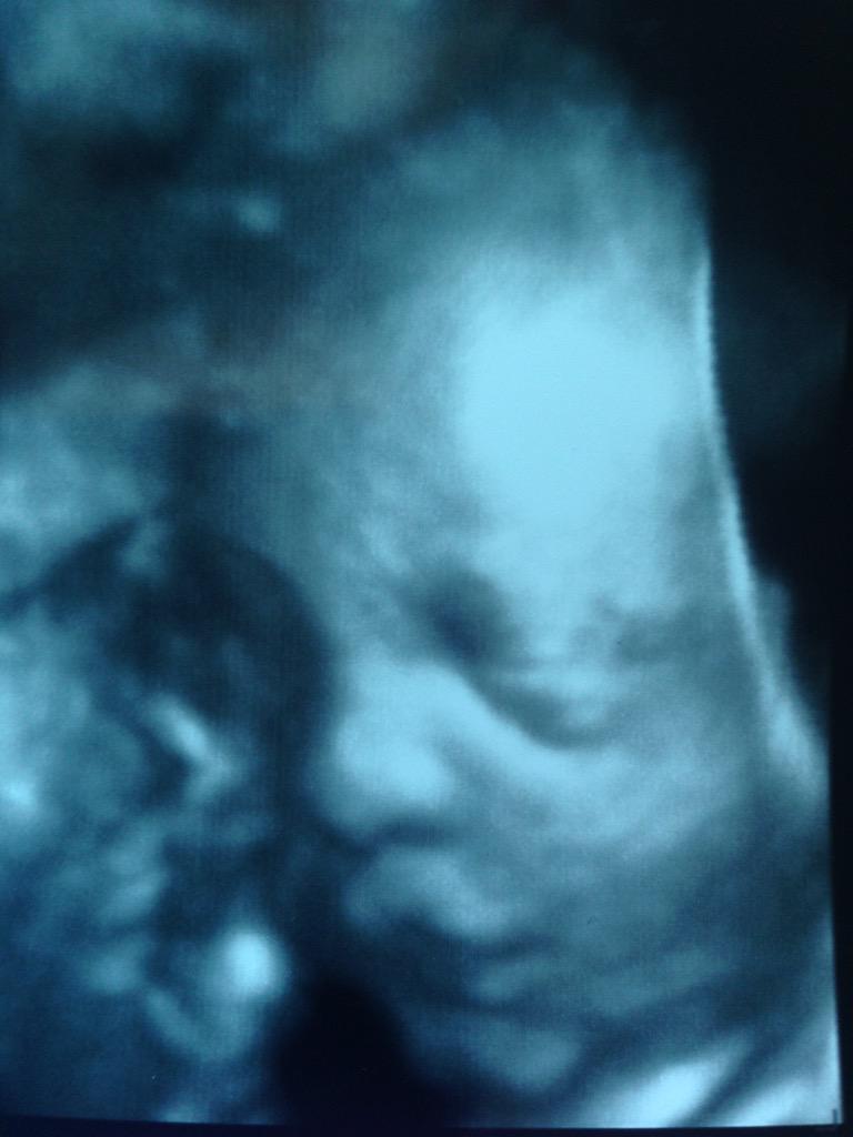 samtaylor20's tweet photo. 4D ultrasound of our littlest tike today! @AMarie_1363 #CruzAveryTaylor http://t.co/gQgFIkbevb
