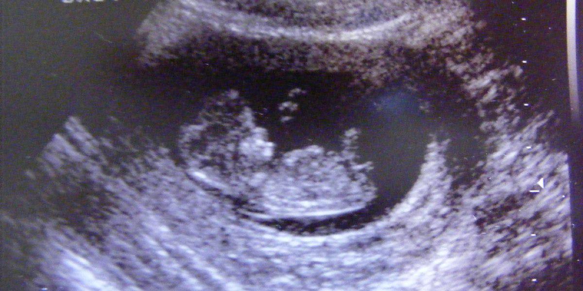 HeftyCo's tweet image. Middle in her pregnancy she notices that the baby is not hers. hefty.co/carolyn-sean-s…