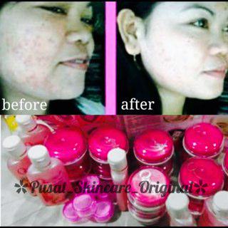 qweena_jogja's tweet photo. Order qweena gratis biospray #biospray #creampemutih #cream #creampencerahwajah #obatjerawatampuh #qweena http://t.co/m2FGeEOVsQ
