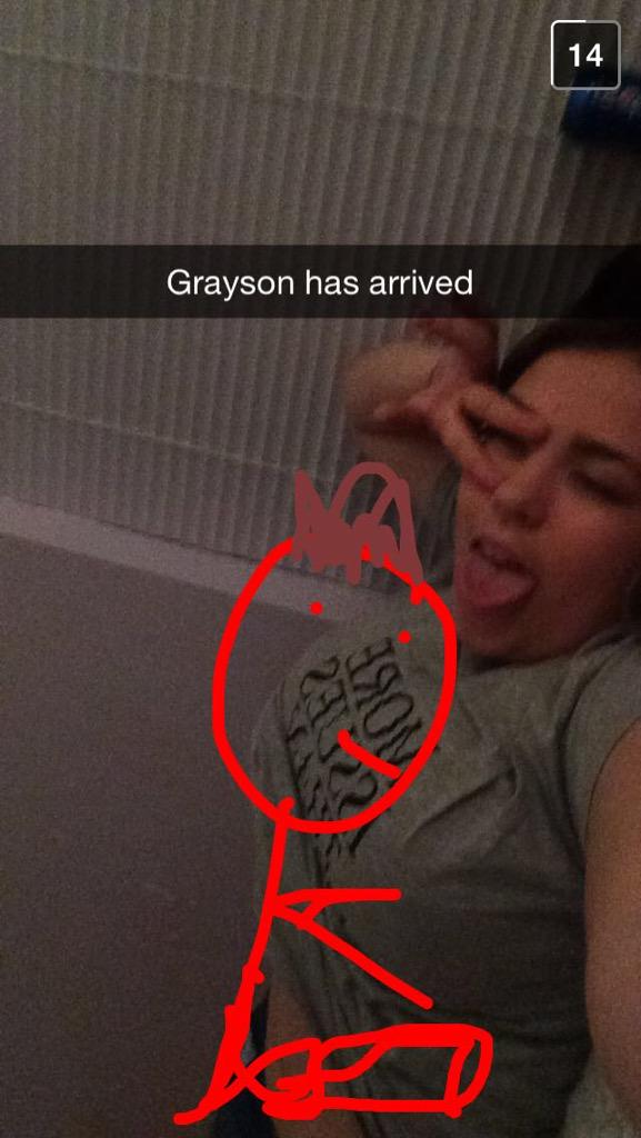 FuckboysExist's tweet photo. @Sextmedolan @GraysonDolan he's on your boob. 😹😹😹😹 http://t.co/n5E0EaayuY