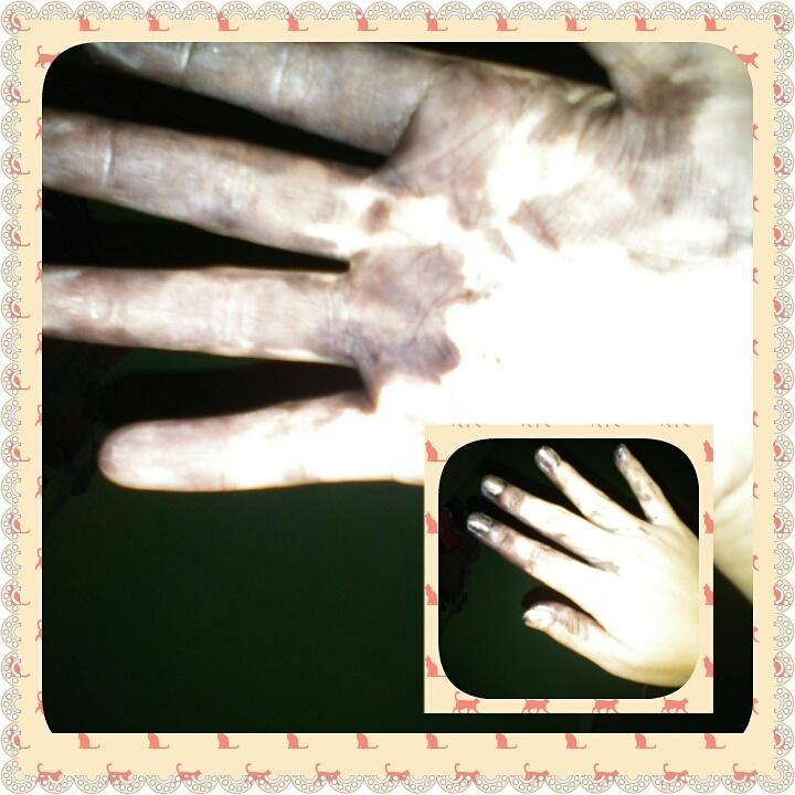 4044f47c47ae44f's tweet image. Malaking Pinsala Talaga XD
#NaturalBlack #PermanentColor