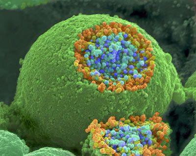 medicalce's tweet photo. Nerve broken open, revealing vesicles containing neurotransmitters. http://t.co/LsQiMYVAi1