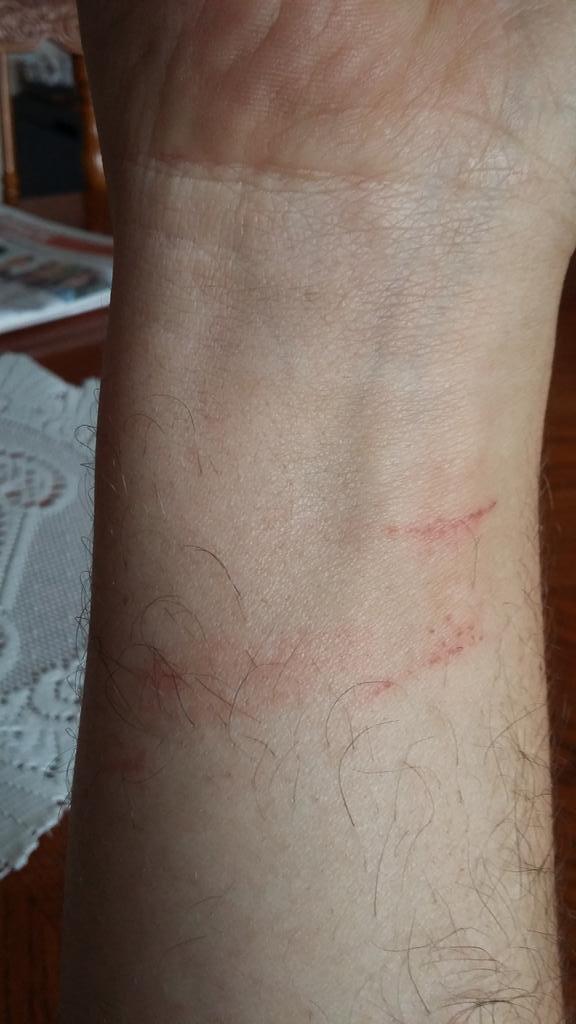 Sullivan_Comms's tweet photo. @AdamMorgan33 @WIXRACINGUK I see your blister & raise you a burnt wrist on a hot rear axle #british24 http://t.co/DcwwLpEzfb