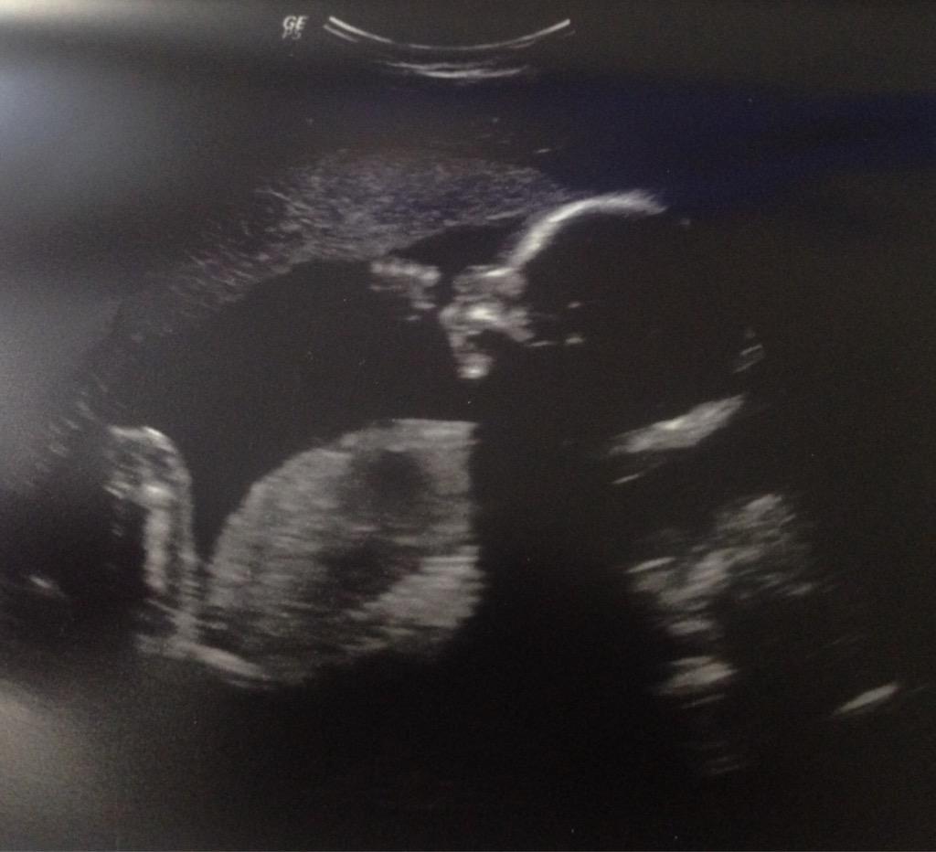 wrightt_hannah's tweet photo. Already crazy about this little guy!!!! 😍💙 #AuntHanny http://t.co/aoro05fLkI