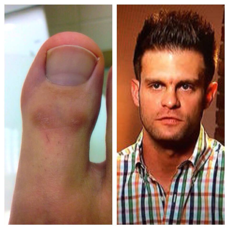 BetsyiRobbins's tweet photo. Toe or Joe? #twinsies #toejoe #BachelorInParadise #bachelor #BachelorNation http://t.co/I1bHcYzFLn