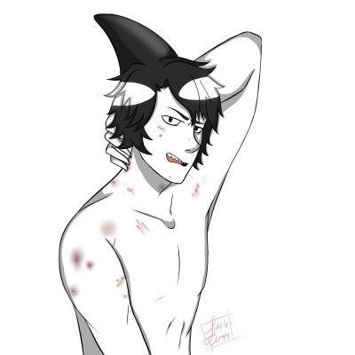 _Trash_Orca_'s tweet photo. " Kitty gets a little ... Feisty, sometimes ... And leaves marks ... " http://t.co/JX9ejtWeyq