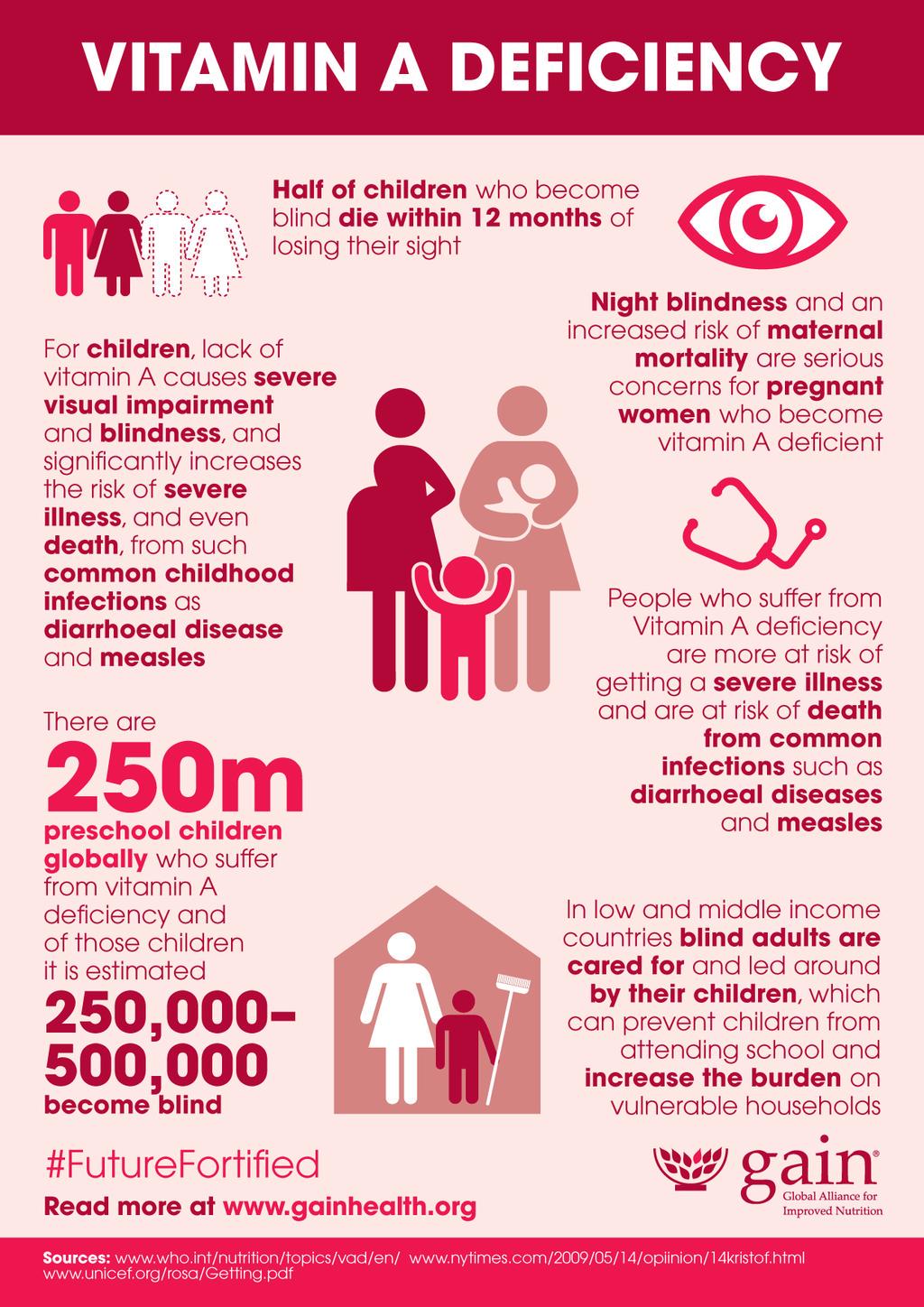 Deficiency Diseases and Malnutrition - GK Notes in PDF - Testbook Blog