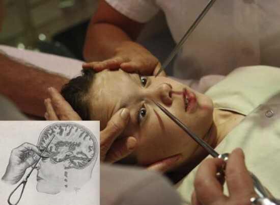 RFYL_TH's tweet photo. เผยการรักษาสุดแปลก ที่เปลี่ยนคน…ให้กลายเป็นซอมบี้!!! http://t.co/FJT0lzKa84 มาดูกันโหดๆ 😂 #RFYLTH http://t.co/beLiHz3CtV