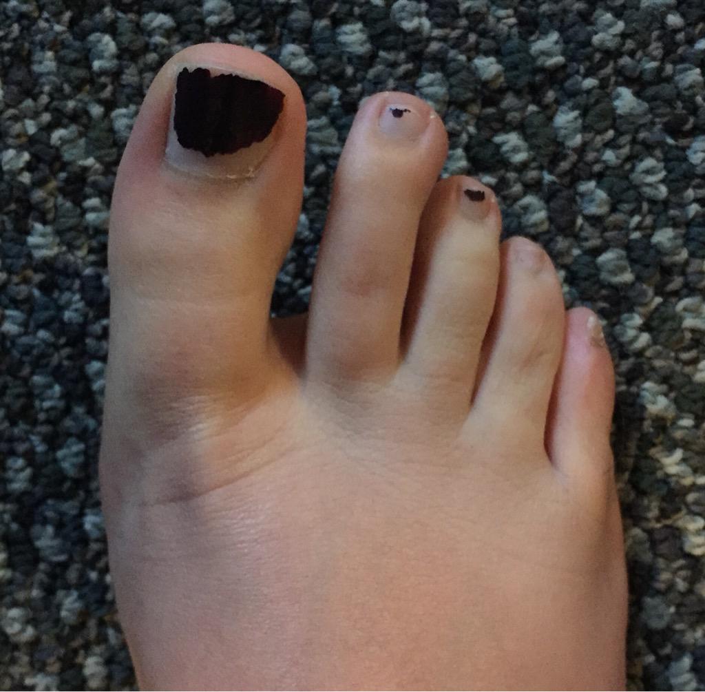Yourallyjohnson's tweet photo. @KevinKleinLIVE flashing my chipped nail polish in this fine #ToeToeTuesday http://t.co/Zu2SwvpDCQ