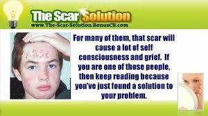 saiful573's tweet image. bit.ly/1HTXmOy
  Clinically Proven
 Dermatologist Approved
 Personally Tested