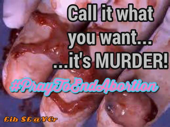 JusticeMcKean's tweet photo. MT @KarrattiPaul: Call it what you want... it's still MURDER! #DefundPP  #WakeUpAmerica http://t.co/R2kUCiRtyi #UnbornLivesMatter #PJNET
