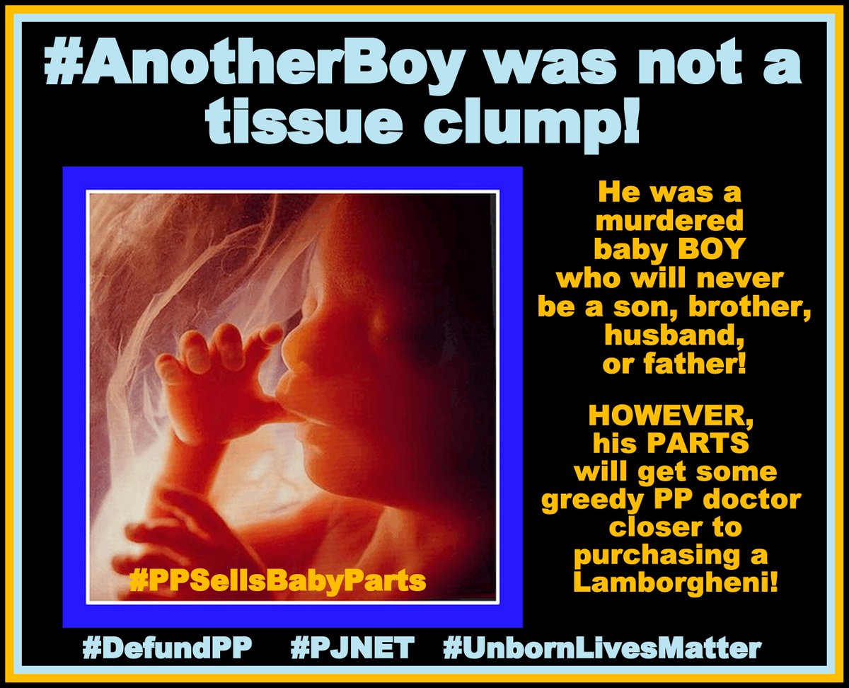 LindaSuhler's tweet image. MT @jstines3: #AnotherBoy was not just a tissue clump! #PJNET #DefundPP #UnbornLivesMatter #WakeUpAmerica