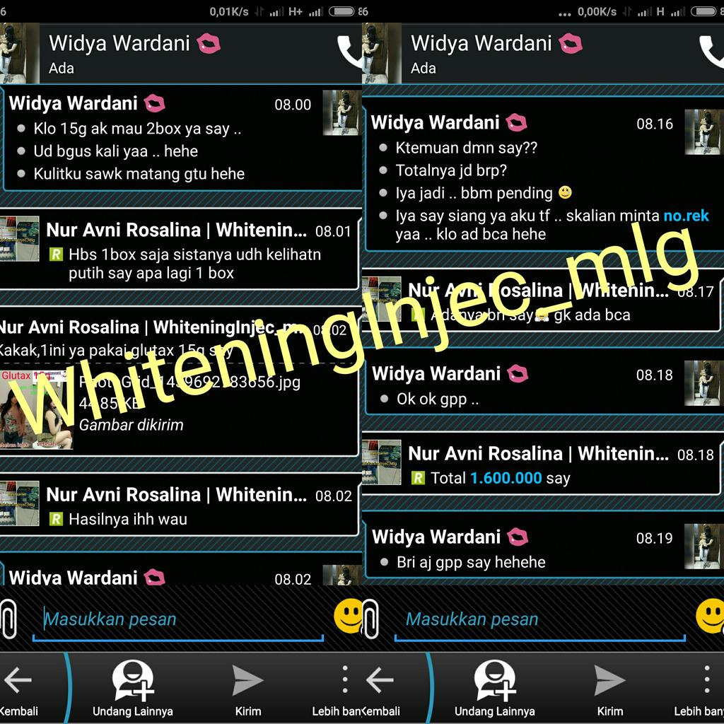 muarifabbas22's tweet image. Cust kami dr WhiteningInject_mlg
#Suntik Putih Malang