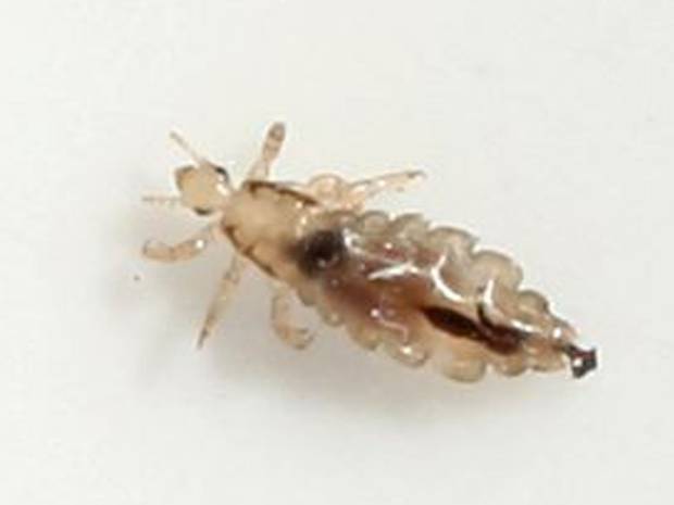 Diseased illegals now spreading mutant lice