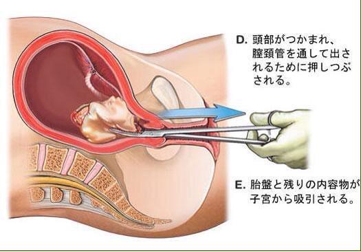 4_kazelove's tweet photo. こんなん見た後でもおろすとか
言えるんかな

頭冷やして考え直せば http://t.co/Onzkk7ami5