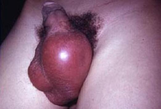MaxenceVariot22's tweet photo. FF100 ne pourrai reprendre l entraînement: irritation aux testicules. Mais ou a t'il encore traîné ?? #JEBAISE-H24 http://t.co/WghcKQJnIH
