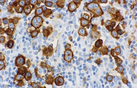 Just released: The September issue of Archives of Pathology &amp; Laboratory Medicine is now available: