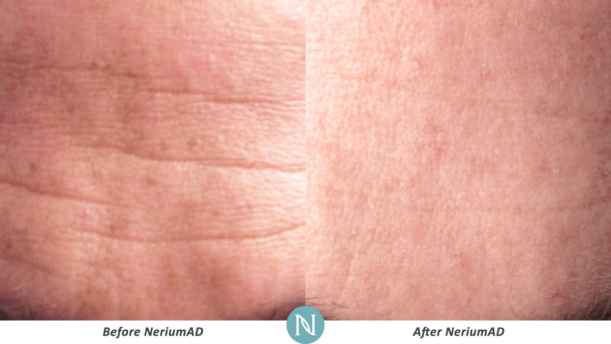 Nerium’s Age-Defying cream continues to offer sensational Real Results! See for yourself:  n.nerium.it/malippert