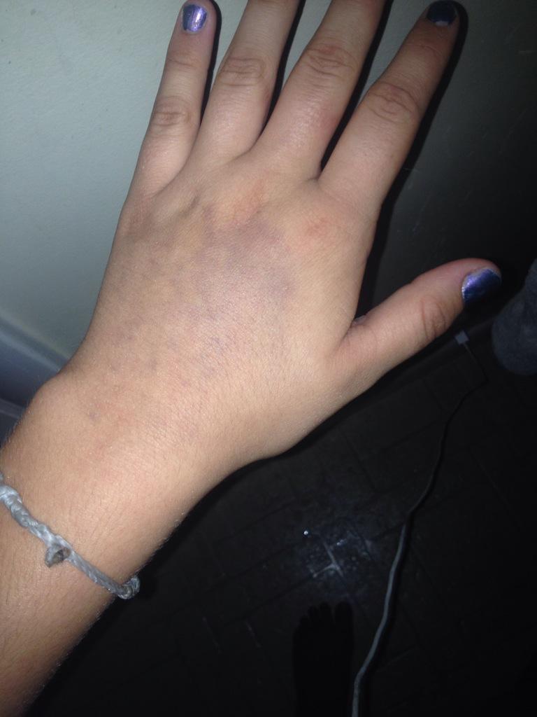 phobaefoster's tweet photo. Tennis is a dangerous game kids. #expert #suffertosucceed http://t.co/MkvFNm9zIb