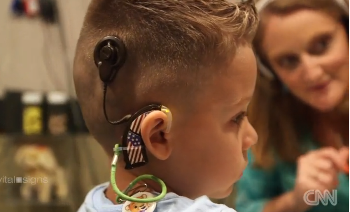 audiologyonline's tweet image. Deaf boy hears for the first time - because of a #bionicear, AKA #auditorybrainstemimplant: cnn.it/1PvjJ2w