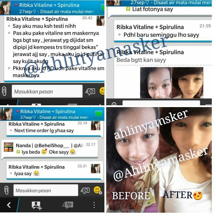 AhlinyaMasker's tweet photo. baru 1 Minggu !! 
Testi BEFOREAFTER kak Ribka
Jerawat Kempess 😀
Muka Lebih Putih 😍
Pin 2B427D72
Sms Wa 08981060123 http://t.co/CxxFEdubIv