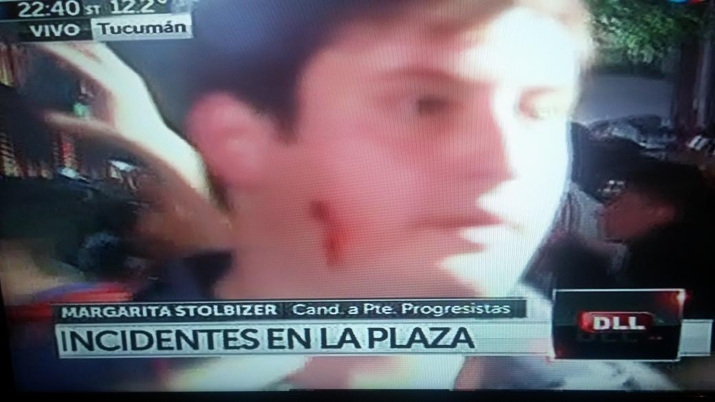 tuitskukas's tweet photo. El Gobierno reprime al pueblo - CFK ASESINA http://t.co/KNEYfqsz1i