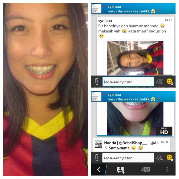 BehelStoreID's tweet image. HOTPROMO
TURUN HARGAA!!!

behel permanen metal 
lengkap tinggal bwa k dokter
450RB-&amp;gt;&amp;gt;185RIBU ATASBAWAH😘


Pin 328498a7