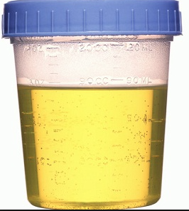 DrHydration's tweet photo. Can an athlete get punished for #doping without any positive urine or blood test? #PDFa15 #PDFa15Q http://t.co/kPlVkBEpei