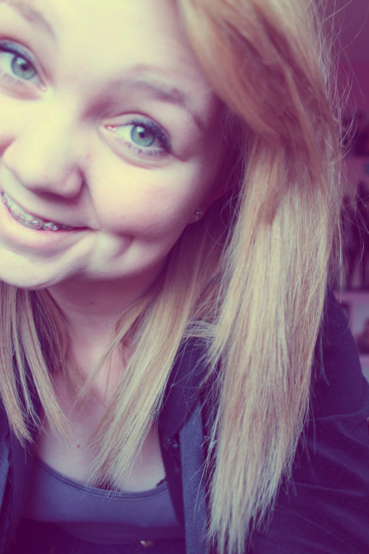 Girls With Braces on Twitter "Awesome Dimples braces http//t.co