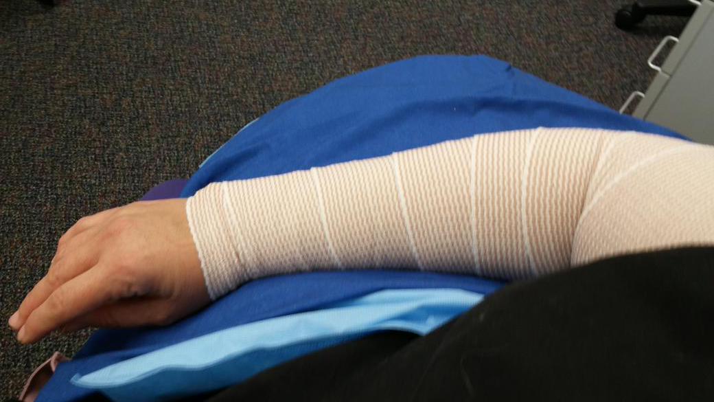 krazyjenni's tweet photo. Meet my new accessory...gonna have to bedazzle for fan expo! #bumwing #ouchie #brokenjenni http://t.co/163SxmJXEL