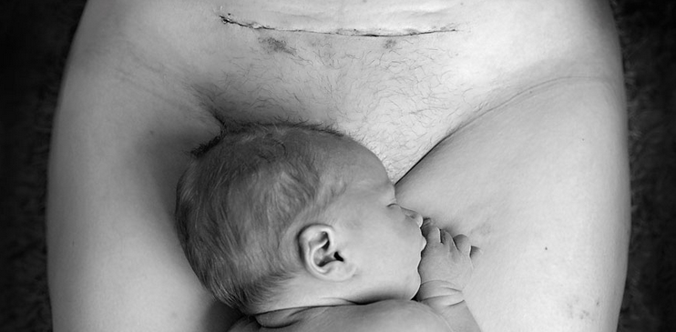 LePlus's tweet photo. Facebook censure une photo post-césarienne : une terrible erreur > http://t.co/QpoKTSMwlm http://t.co/q5L3RPQh4o