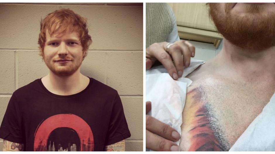 Ed Sheerans Massive New Lion Tattoo  Access Online