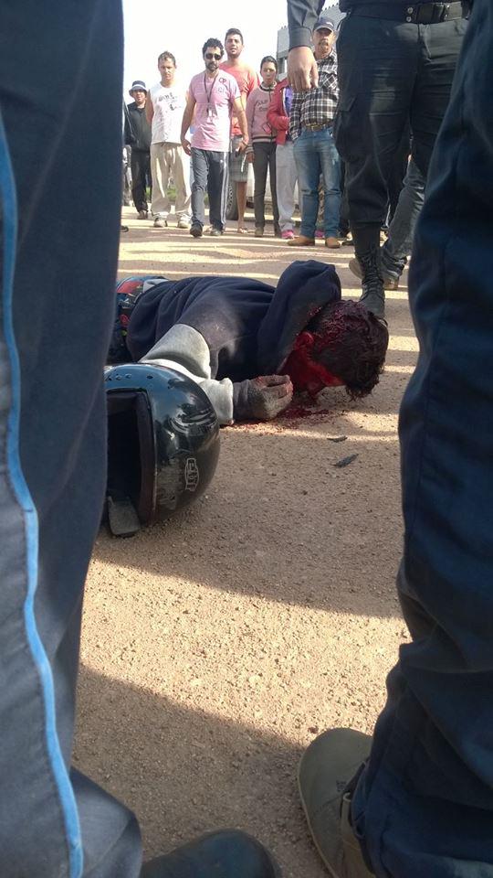 ElOjoChurrinche's tweet photo. Delincuente abatido por la policia de tres tiros en el Chuy lado Uruguayo, informe y Fotos  https://t.co/CSTyF3CKlg http://t.co/b4XEPbcRlx