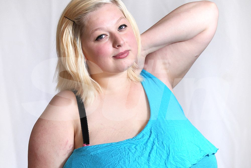 As The Nhs Denies A Breast Reduction For 42n Ginny We Meet More Women Troubled By Big Boobs