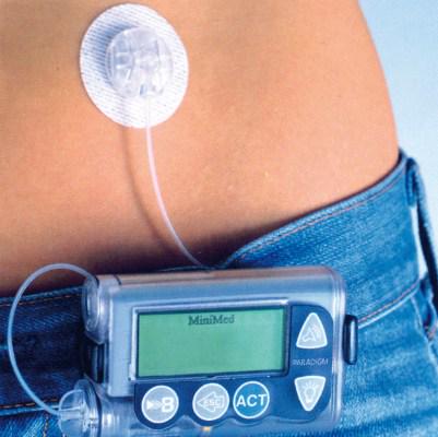 #FMDInfo ¿Bombas de insulina pueden reducir el riesgo de muerte por problemas cardiacos? ow.ly/RtZUo
