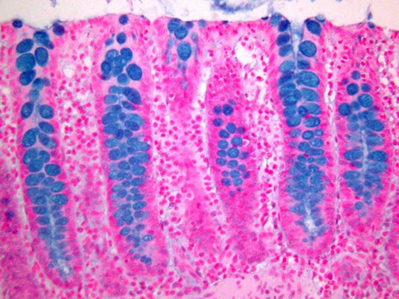 Over 30 special stains now searchable on Visabl.com for #histology #NSH #NSHSC.
