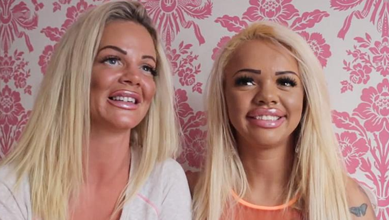 Mother And Daughter Used 039 Sugar Daddy 039 To Spend 86 000 On Matching Plastic Surgery Aol Com Scoopnest