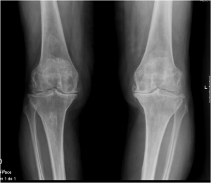 KupeevClinic's tweet photo. Остеоартроз и болезни суставов http://t.co/jqGpoWQNIC http://t.co/I1Fznnent8