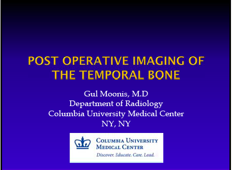 JennyKHoang's tweet photo. .@gmoonis fm @ColumbiaMed - fantastic lecture at #ASHNR15 on postop imaging of T-bones. Tweeting key slides tomorrow. http://t.co/6TB2nPBsnL