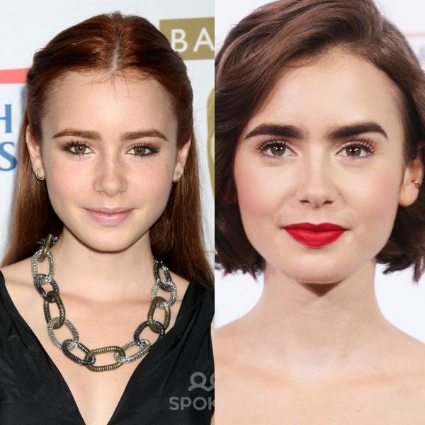 Lily Collins Before And After